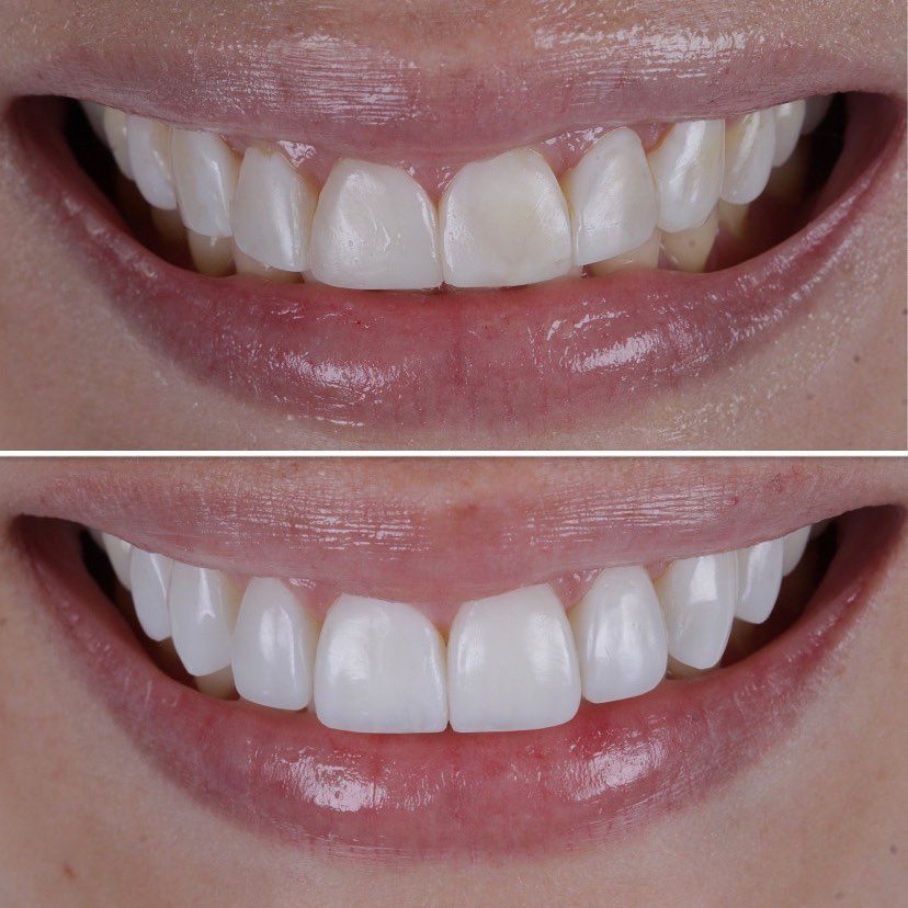 Antes e depois de um caso real da clínica